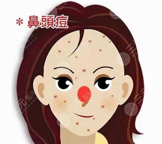尋求醫(yī)美緩解：適用于嚴重痤瘡病例