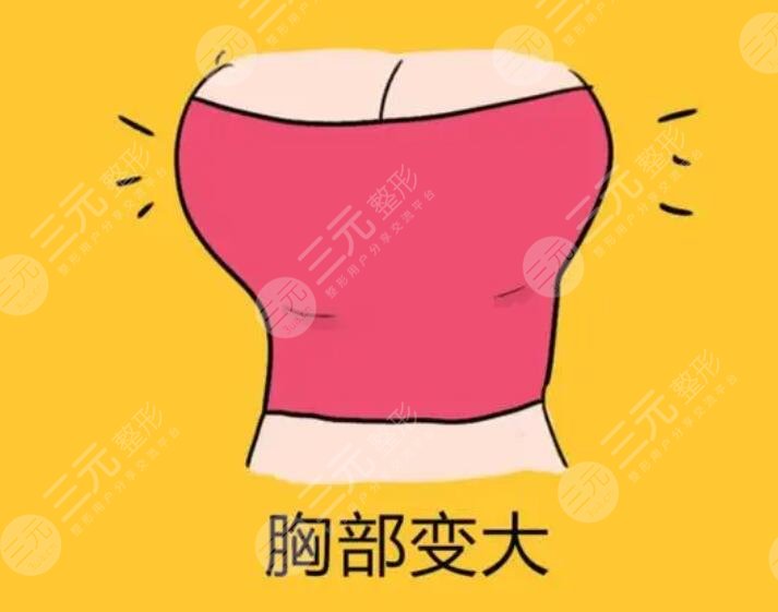 強生鉑蘊隆胸假體怎么樣？這種假體的優(yōu)勢是什么？呈現(xiàn)的效果怎么樣？