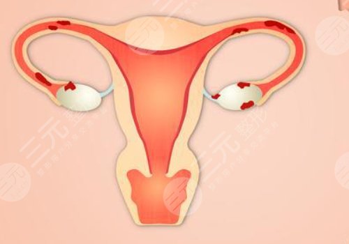 女性私處修復(fù)手術(shù)大概多少錢？