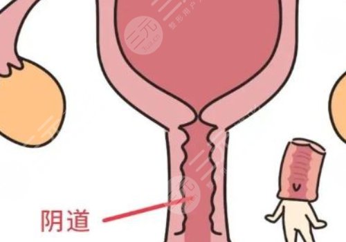 女性私處修復(fù)手術(shù)大概多少錢？