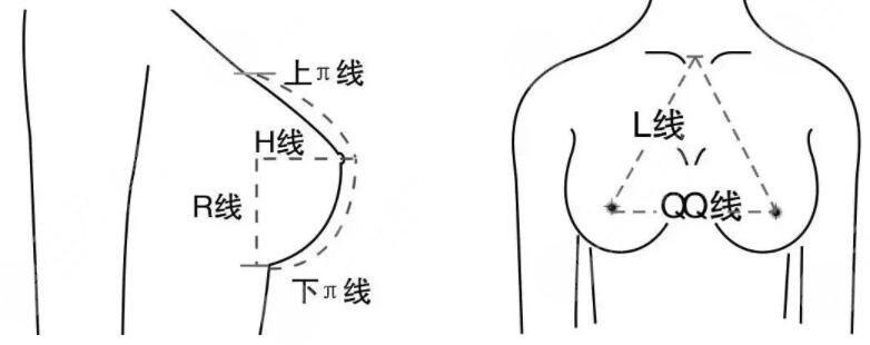 做強(qiáng)生假體隆胸需要注意什么?