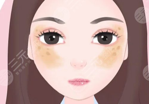 臉上長了色斑是什么原因造成的?