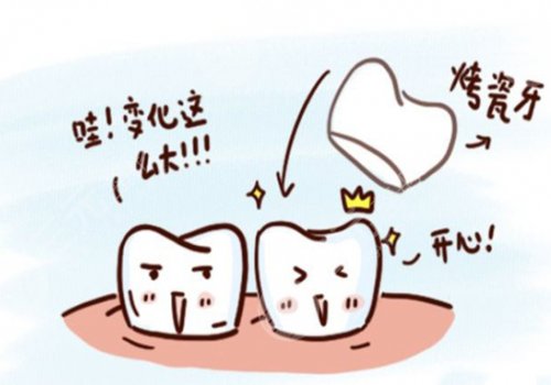 鈷鉻烤瓷牙套怎么樣？
