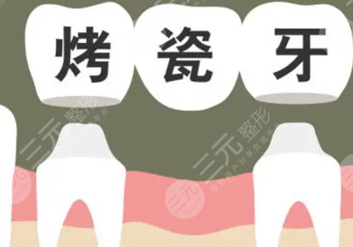 鈷鉻烤瓷牙套怎么樣？