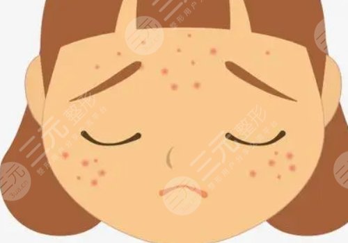 如何去除臉上的青春痘？