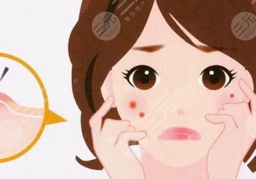 如何去除臉上的青春痘？
