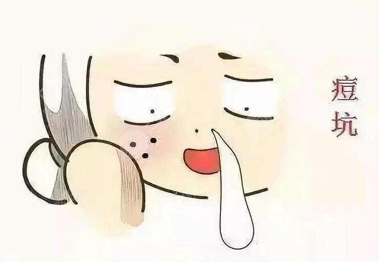 激光磨皮去痘印有效嗎？手術(shù)注意事項(xiàng)有哪些？哪些人適合做？
