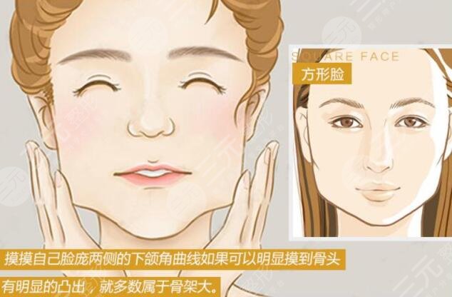 下頜角肥大是什么原理?