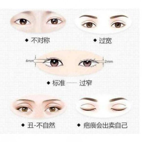 雙眼皮修復(fù)大概多少錢(qián)呢？