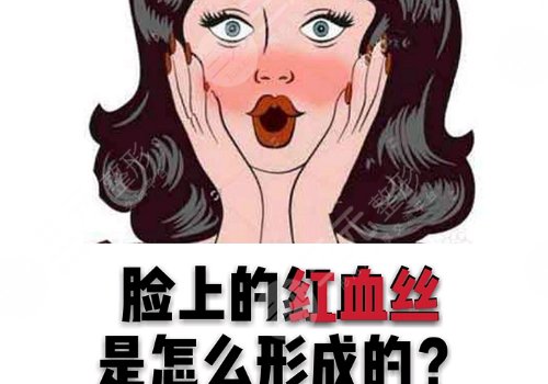怎么減少紅血絲的產(chǎn)生？