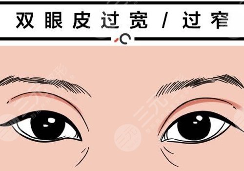 雙眼皮修復(fù)大概多少錢(qián)呢？