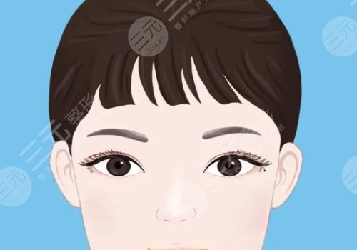 雙眼皮修復(fù)大概多少錢(qián)呢？
