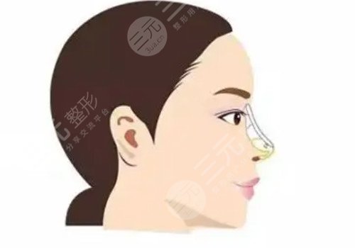 鼻梁山根低怎么辦？