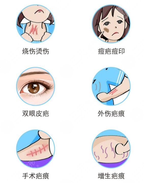 像素激光去疤術后注意事項