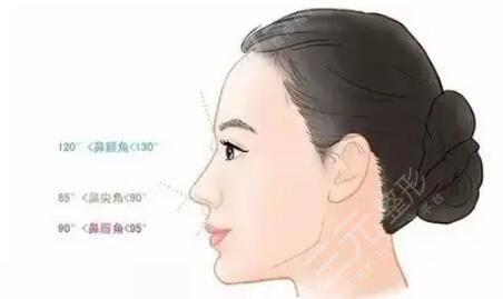 自體軟骨隆鼻好不好看？是從哪里取軟骨？優(yōu)缺點(diǎn)一文匯聚！