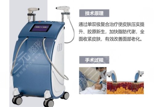 深藍(lán)射頻做一次有效果嗎？