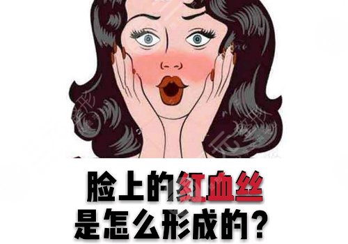臉上長紅血絲怎么去掉？