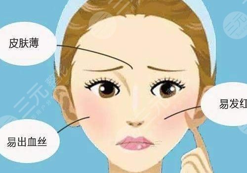 臉上長紅血絲怎么去掉？