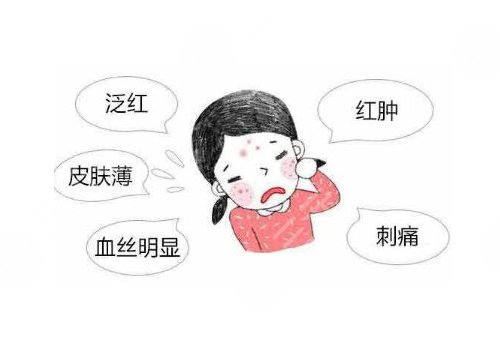 臉上長紅血絲怎么去掉？