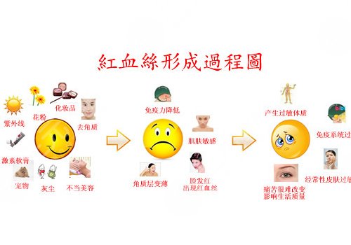 臉上長紅血絲怎么去掉？