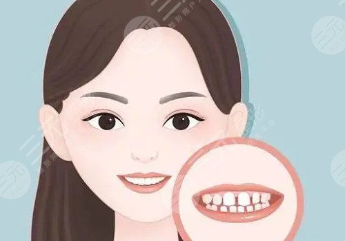 冷光美白牙齒對牙齒有什么傷害？