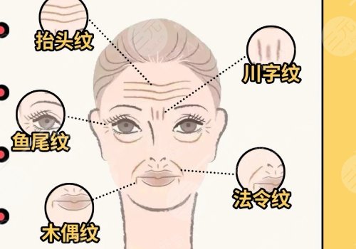 臉上皮膚松弛下垂怎么辦？