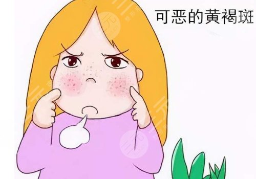 怎樣去除面部黃褐斑有效？