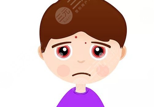 臉上有痘印怎么辦才能去掉呢？