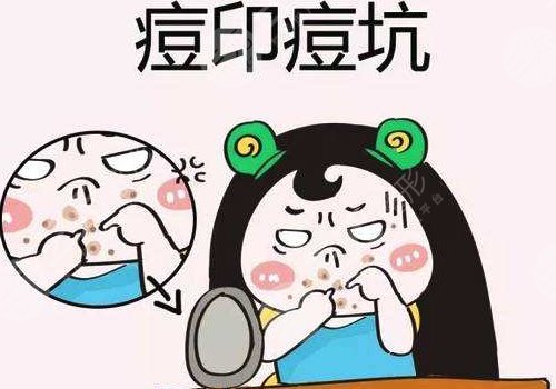 臉上有痘印怎么辦才能去掉呢？