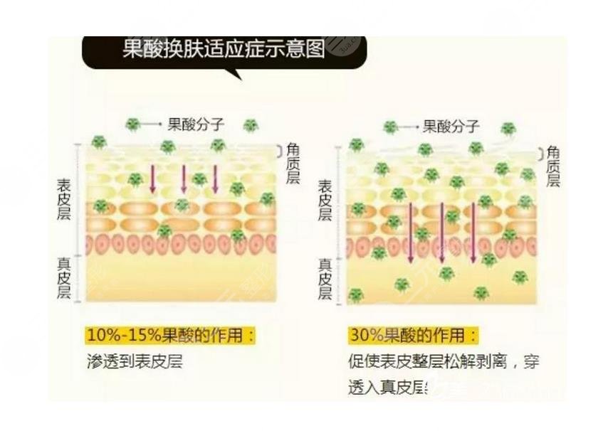 臉上皮膚粗糙毛孔粗大怎么才能恢復(fù)得好？