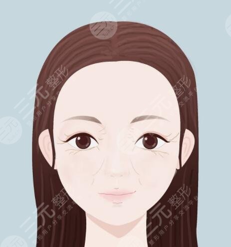 怎樣防止魚尾紋及保養(yǎng)方法，分為醫(yī)美和非醫(yī)美兩種方案！