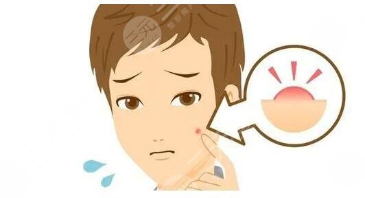 中醫(yī)祛痘效果如何?。慷患撊绾巫o理？
