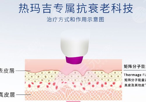 雙cwt熱瑪吉與普通熱瑪吉什么區(qū)別？
