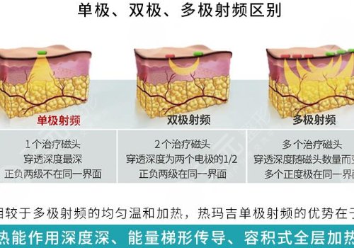 雙cwt熱瑪吉與普通熱瑪吉什么區(qū)別？