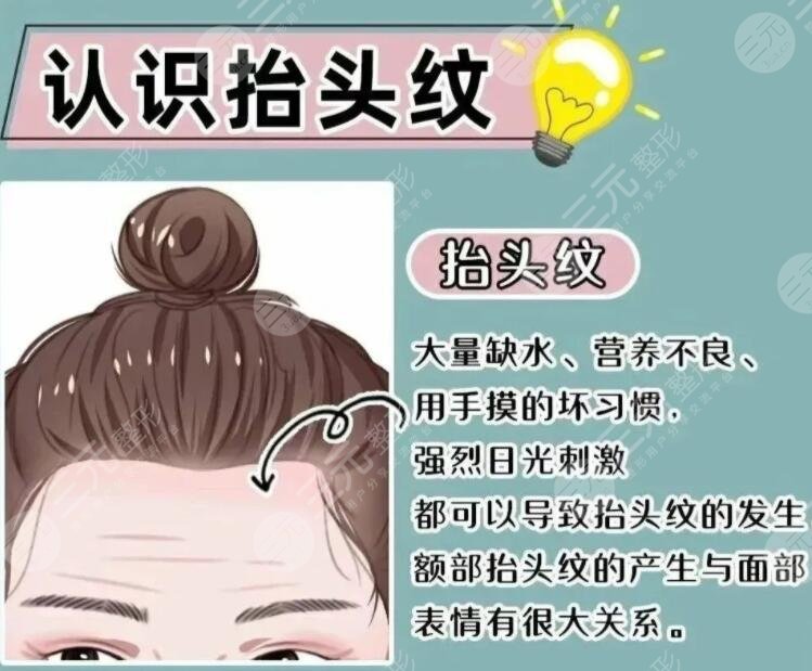 抬頭紋整形多少錢一般？哪些方法可以改良抬頭紋？