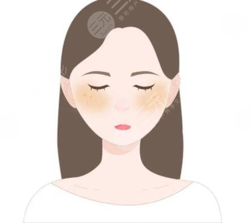 去除黃褐斑價(jià)格大概是多少？哪種方式祛斑見(jiàn)效快！