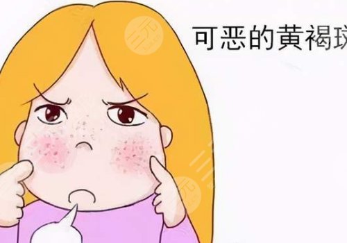 激光祛斑會不會反彈？
