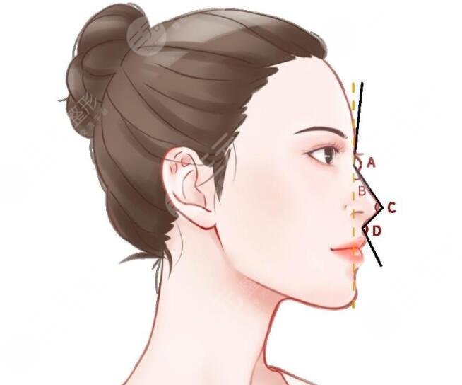 膨體隆鼻感染的癥狀是什么？出現(xiàn)這3個(gè)癥狀一定要及時(shí)就醫(yī)！