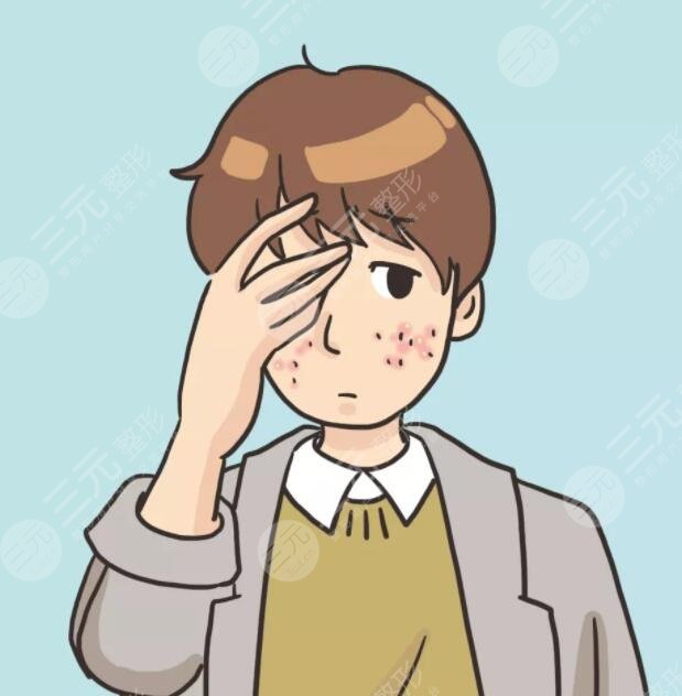 男生祛痘的小竅門是什么？做好這5點可以大大緩解痘肌！