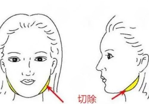 上海時光整形頜面好不好?