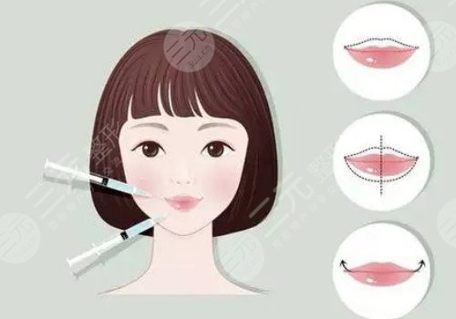 唇部注射玻尿酸需要注意什么？