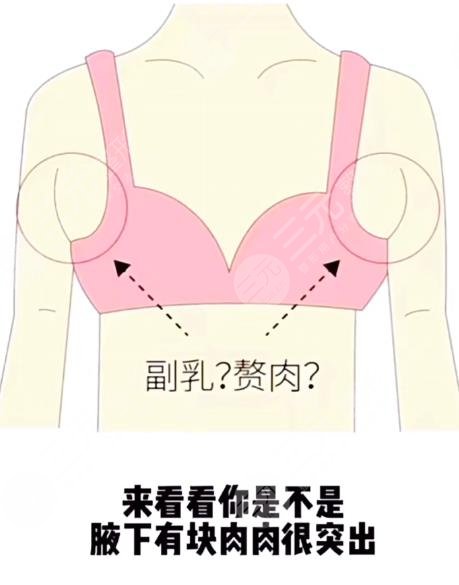 6大腋下副乳運動消除方法！4分鐘消除副乳！甩掉拜拜肉！