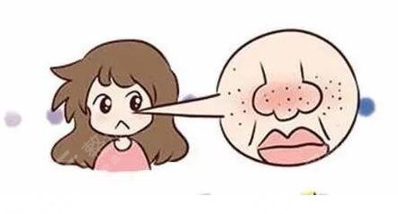 注意防曬