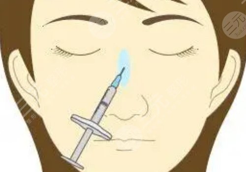 微調(diào)整形有風險嗎？