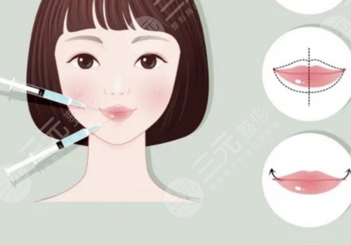 微調(diào)整形有風險嗎？