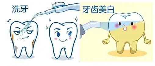 冷光牙齒美白的幾個步驟是什么?