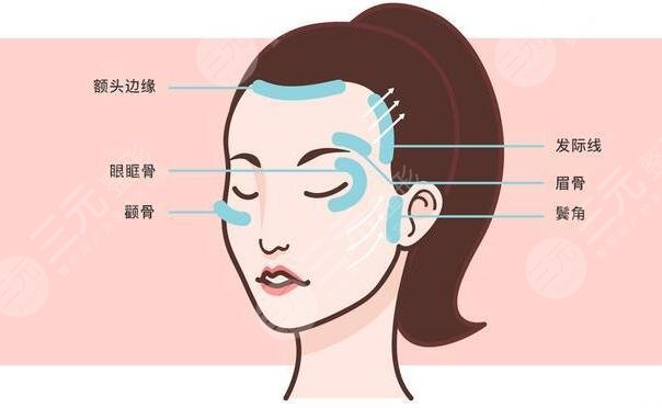 注射除皺的注意事項
