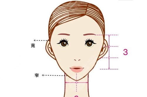 輪廓手術(shù)過程圖片|網(wǎng)友恢復案例