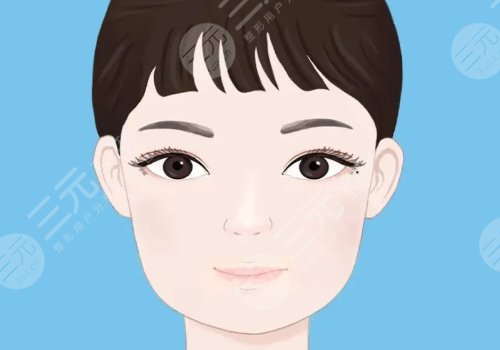 輪廓手術(shù)過程圖片|網(wǎng)友恢復案例
