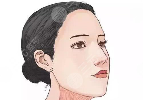 輪廓手術(shù)過程圖片|網(wǎng)友恢復案例